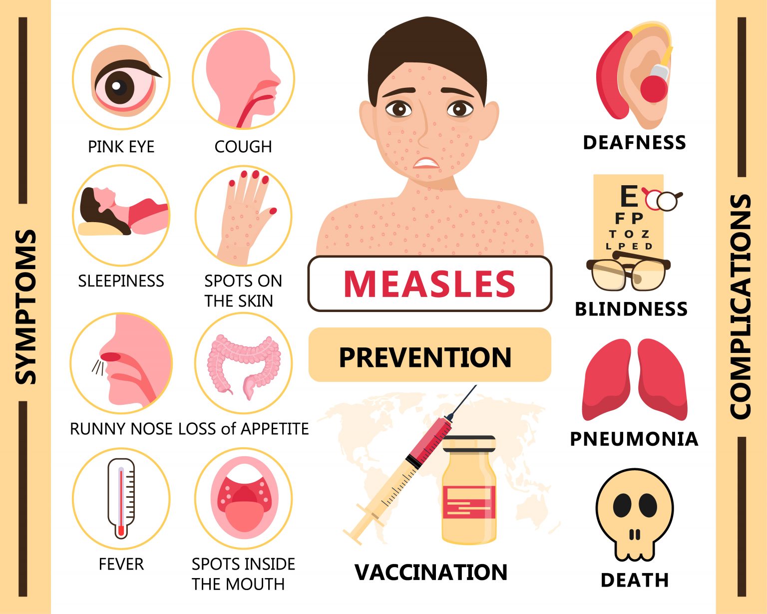 MEASLES CAUSES, SYMPTOMS, RISK FACTORS, EFFECTS, AND PREVENTION OF